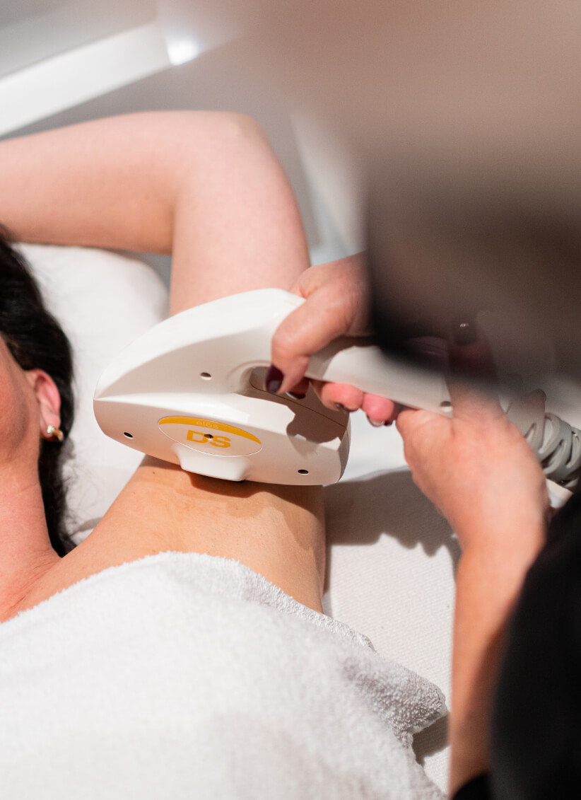 intense-pulsed-light-hair-removal-ipl-treatment